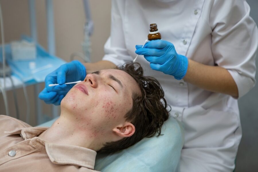 acne treatment in a teenager